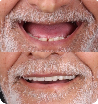 sorriso1