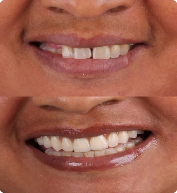 sorriso2